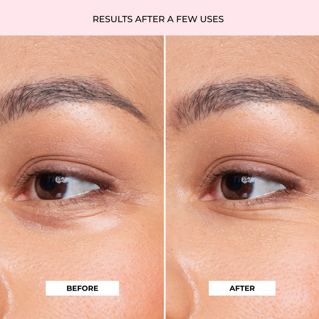 Mascarilla para contorno ojos, hidratante, reafirmante, antiarrugas